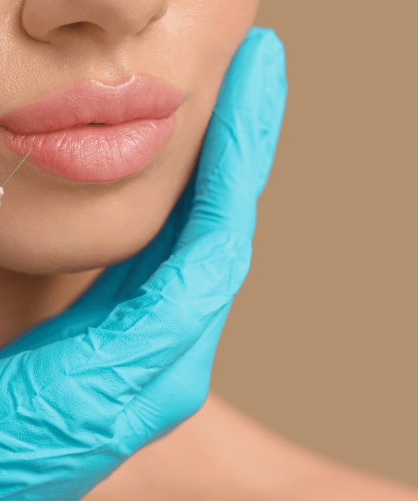 كل ما تحتاجين معرفته عن فيلر الشفايف