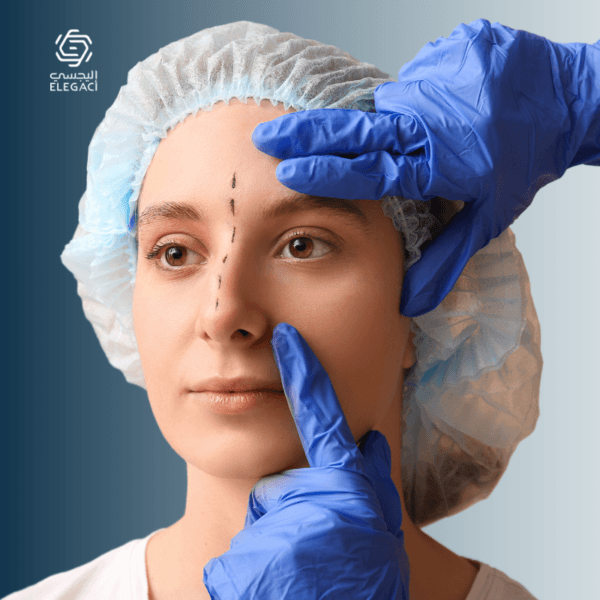 تجميل الانف