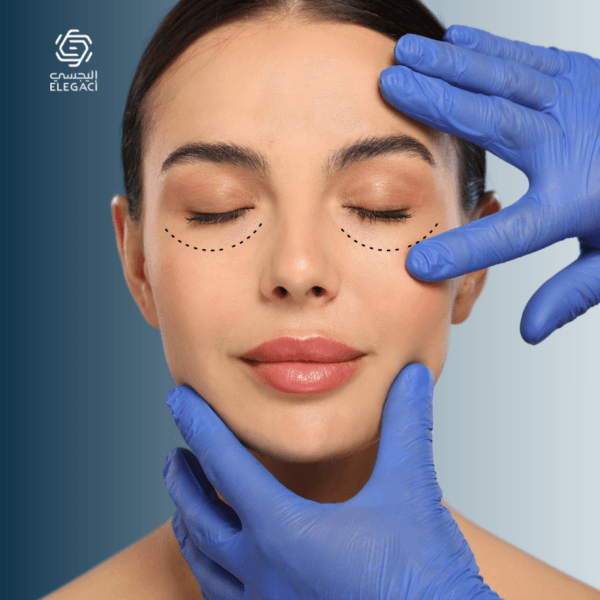 شد الجفون السفلية