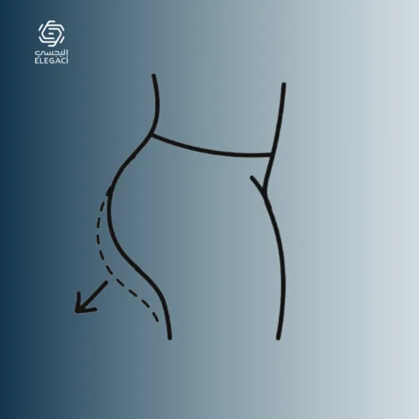شد المؤخرة البرازيلية